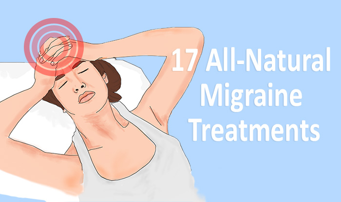 migraine treatments